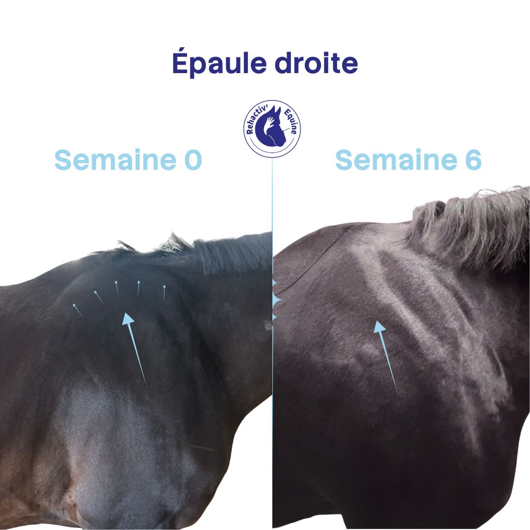 Dissymétrie des épaules, renforcement musculaire